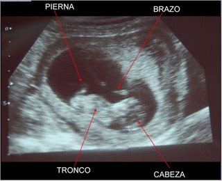 Embarazo 12 semanas 4 dias